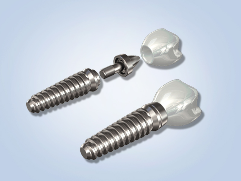 Are Titanium Implants The Best Solution Dr Terence Jackson